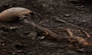 Skeletons in Muzaffarpur Hospital: 3-Member Committee Begins Probe