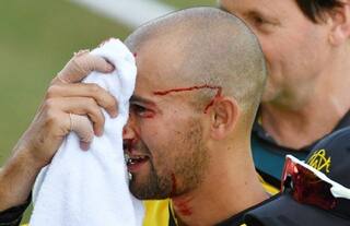 Ashton Agar Suffers Gruesome Injury During Marsh One-Day Cup | WATCH VIDEO