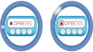 Diabetes: This is How it Impacts Your Life