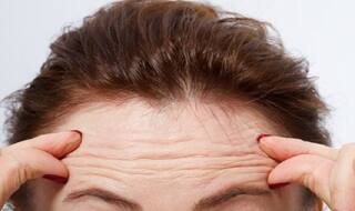 These Lifestyle Changes Can Help You Bid Adieu to Forehead Wrinkles