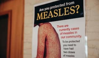 Complications That May Follow Measles