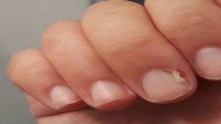 Dip, Clip, Disinfect, And Moisturize Your Hangnails to Get Rid of Pain