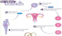 Common Myths Surrounding in Vitro Fertilization
