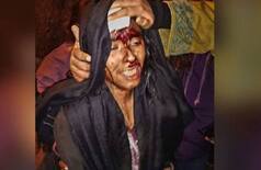 'Today My Daughter, Tomorrow Maybe Me', Says Injured JNUSU President Aishe Ghosh's Father