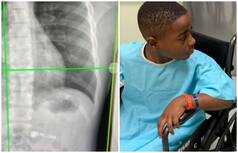 7-Year-Old Georgia Boy Ends Up in Hospital After He Swallows An AirPod He Got For Christmas