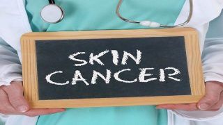 Skin Cancer: Know The Types And Preventive Measures