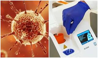 Coronavirus Alert: आधे से ज्यादा मरीजों में नहीं दिखते कोरोनावायरस के लक्षण, पर होता है उन्हें संक्रमण, कितना बढ़ा खतरा?