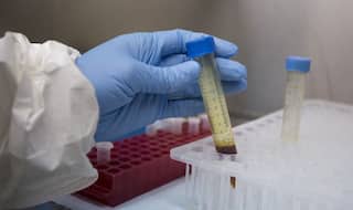 Two Doctors Test Positive For COVID-19 at Ram Manohar Lohia Hospital