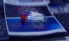 Coronavirus In Pakistan: 2000 से ज्यादा नए मामले, कोरोना संक्रमितों का आंकड़ा 34 हजार के पार