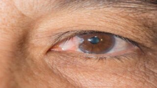 Early Signs of Glaucoma Progression to Blindness Can be Spotted by AI