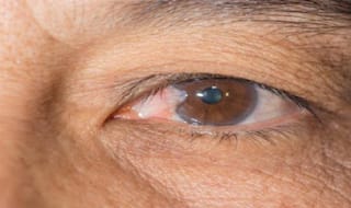 Early Signs of Glaucoma Progression to Blindness Can be Spotted by AI