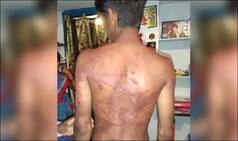 Telangana Men Brutally Assault And Force 18-Year-Old Dalit Boy to Drink Urine For Dating Girl From Their Community