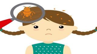 Hair-Care Tips: How to Get Rid of Head Lice Using Olive Oil