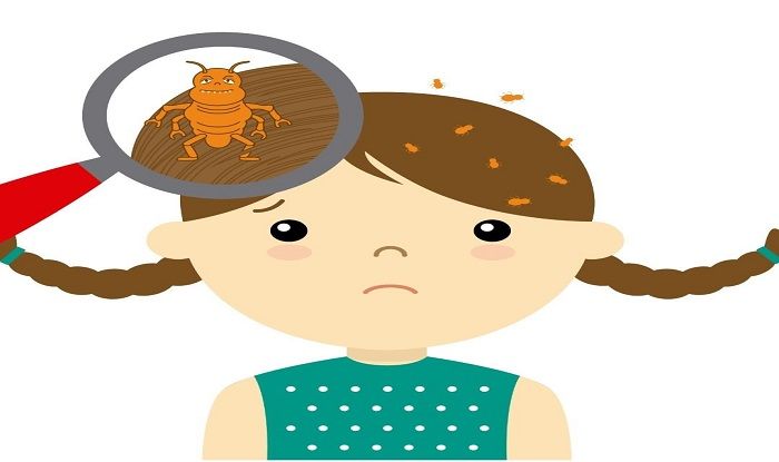 Hair Care Tips How To Get Rid Of Head Lice Using Olive Oil