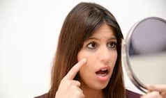 Here is How to Use Castor Oil to Get Rid of Dark Circles