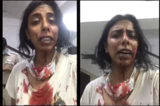 Video of Blood-Soaked NGO Volunteer Goes Viral After Others From 'Neighbourhood Woof' Brutally Assaulted by Locals in Delhi