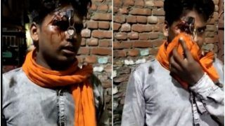 Shocking Police Brutality! Uttarakhand Cops Stab Key Into Man's Forehead For Not Wearing Helmet | Watch