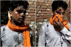 Shocking Police Brutality! Cops Stab Key Into Man's Forehead For Not Wearing Helmet | Watch