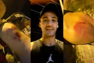 Bigg Boss 13 Fame Asim Riaz Gets Attacked by Unknown People, Suffers Multiple Injuries