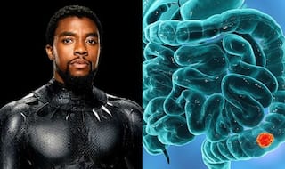 All About Colon Cancer: Symptoms And Treatment of Disease That Took Black Panther Aka Chadwick Boseman's Life