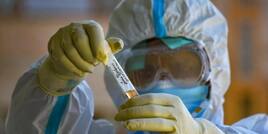 Coronavirus New Symptoms: फिर से सामने आए कोरोना वायरस के नए असामान्य लक्षण, ना करें नजरअंदाज