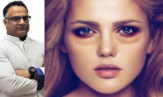 World Renowned Dermatologist Suggests Skincare Tips to Get Rid of Dark Circles And Baggy Eyes | Tips & Tricks