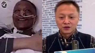 कोरोना के चलते काली हो गई थी चीन के इस डॉक्टर की त्वचा, अब नॉर्मल होकर लौटा; साथी गंवा चुका है जान