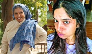 जब 'सांड की आंख' की शूटिंग के दौरान जल गया भूमि पेडनेकर का फेस, सुनिए पूरी दास्तां