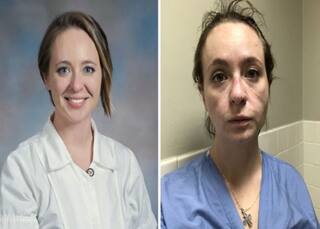 OMG! कोविड मरीजों के ईलाज में लगी नर्स का 8 महीने में इतना बुरा हाल, तस्वीरें Viral