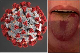 Explained: Covid Tongue And How You Catch Early Signs