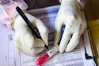Maharashtra: Pimpri Chinchwad Emerges as COVID Hotspot, Sees 4-fold Rise in Cases in 30 Days