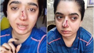 Zomato Delivery Man Attacks Bengaluru Woman, Nasal Bone Left Broken | Watch Shocking Video