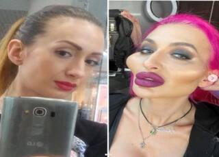 Model With Big Cheeks: तौबा! इतने उभरे गाल, जानें कैसे हो गया ये हाल