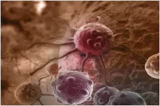  Blood Cancer Signs: अगर शरीर में दिखने लगे ये लक्षण तो तुरंत करें डॉक्टर से संपर्क, ब्लड कैंसर के हो सकते हैं संकेत