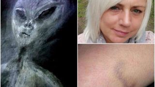 Woman Claims She Has Been Kidnapped by Aliens 52 Times in a UFO, Says Marks on Her Body Prove It!