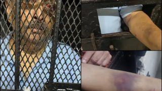 New Photos Show Mehul Choksi in Dominica Police Custody, Bruises on His Body