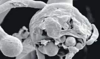 Black Fungus के बाद अब White Fungus मिलने से मचा हड़कंप, ज्यादा है खतरनाक, ऐसे करता है अटैक