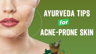 Got Acne-Prone Skin? Ayurveda Remedies Explained | Dr. Sailee Modi, Vedicure Healthcare and Wellness
