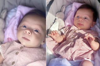 Baby in UK is 'Turning to Stone' Because of THIS Rare Health Condition, Read on