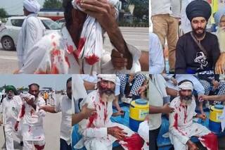 किसानों पर पड़ी लाठी भाजपा सरकार के ताबूत में कील साबित होगी: कांग्रेस