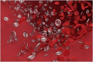Covid-19 Infection Puts Surgical Patients At High Risk Of Blood Clots: study