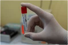 Coronavirus After Effect: Study Reveals Higher Risk of Blood Clots Up to 6 Months After COVID, Even in Mild Cases