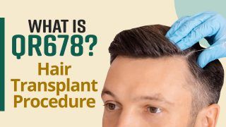 Hair Treatment : What Is QR 678 Hair Transplant ? Here Is All You Need To Know