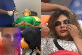 Rakhi Sawant Undergoes Nose Surgery Months After Her Fight With Jasmin-Nikki In Bigg Boss 14 | Watch