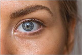 Skincare Routine: How to Protect Under-Eye Skin by Overtime Screentime