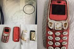 'Too large to Digest': Man Swallows Entire Nokia 3310 Phone, Undergoes Surgery to Get it Removed