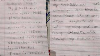 Assam Siblings Write to PM Modi and CM Himanta to 'Take Necessary Action' as Their Adult Teeth Weren't Growing and They Had Trouble Chewing Food