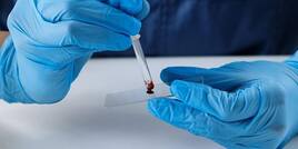 Supreme Court Says Cannot Force Anyone For DNA Test, Calls It Impinge On Liberty, Privacy