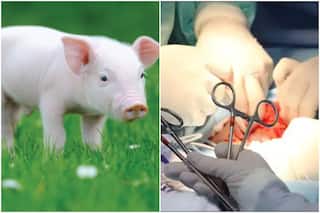 Pig Kidney Works In Human: पहली बार इंसान में लगाई गई सुअर की किडनी, जानें आगे क्या हुआ