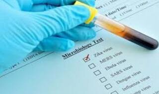 Zika Virus in Lucknow: कानपुर के बाद अब लखनऊ पहुंचा जीका वायरस, दो मामले सामने आये